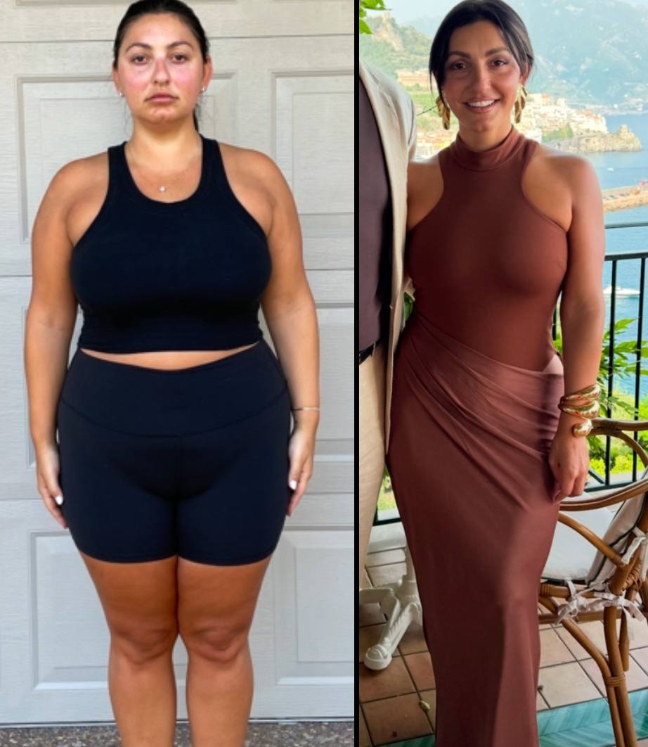 imagen de antes y despues de cliente